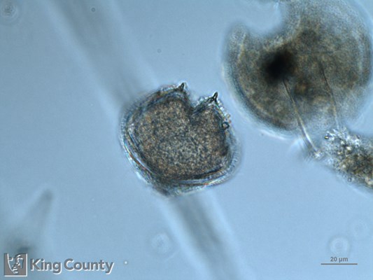 Photo of Protoperidinium conicum/Protoperidinium leonis
